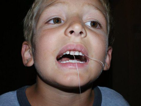 Вырывание зуба ниткой