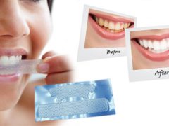 Как пользоваться полосками для отбеливания зубов?