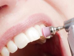 Из-за чего после чистки зубов могут болеть зубы?