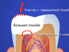 Что можно сделать, если болит зуб после лечения?