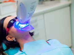 Процедура отбеливания зубов Zoom 3