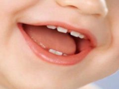 Порядок и схема роста молочных зубов у детей