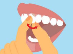 Что делать, если шатаются зубы?