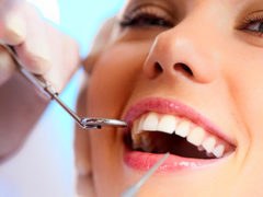 Зачем делают профессиональную чистку зубов?