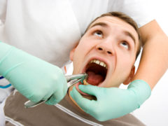 Возможные осложнения после удаления зуба