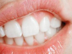 Как устранить боль в десне под зубом при нажатии?