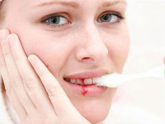 Возможные причины кровоточивости десен при чистке зубов