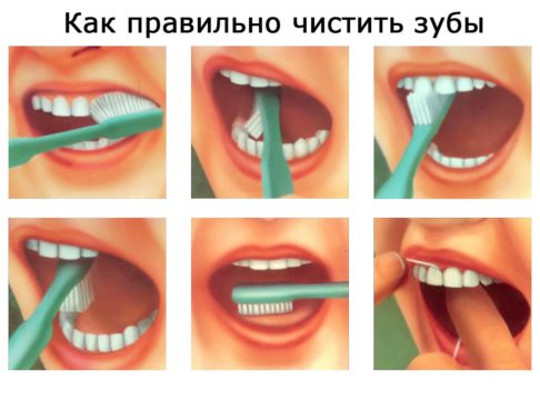 Чистка зубов правильно